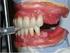 Vliv hloubky skusu na prostor pro dolní frontální zuby The impact ofoverbite on the space available forlower anterior teeth