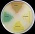 Bakterie v mikrobiologii kultivujeme (pěstujeme) na tekutých a pevných. si živin. obohacujících ch agarový gel. Kolonie. Micrococcus luteus