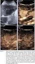 COMPARISON OF CONTRAST-ENHANCED ULTRASONOGRAPHY AND CT IN THE CLASSIFICATION OF RENAL CYSTIC LESIONS