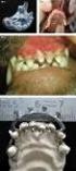 Veterinární ortodoncie: posun 4 zubů pomocí elastických prvků a labiálních oblouků