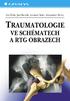 TRAUMATOLOGIE VE SCHÉMATECH A RTG OBRAZECH