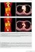 Zhoubné nádory v roce 2005 Malignant neoplasms in 2005