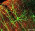 1 Neuronové sítě - jednotlivý neuron